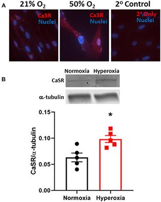 Calcium-Sensing Receptor Contributes to Hyperoxia Effects on Human Fetal Airway Smooth Muscle